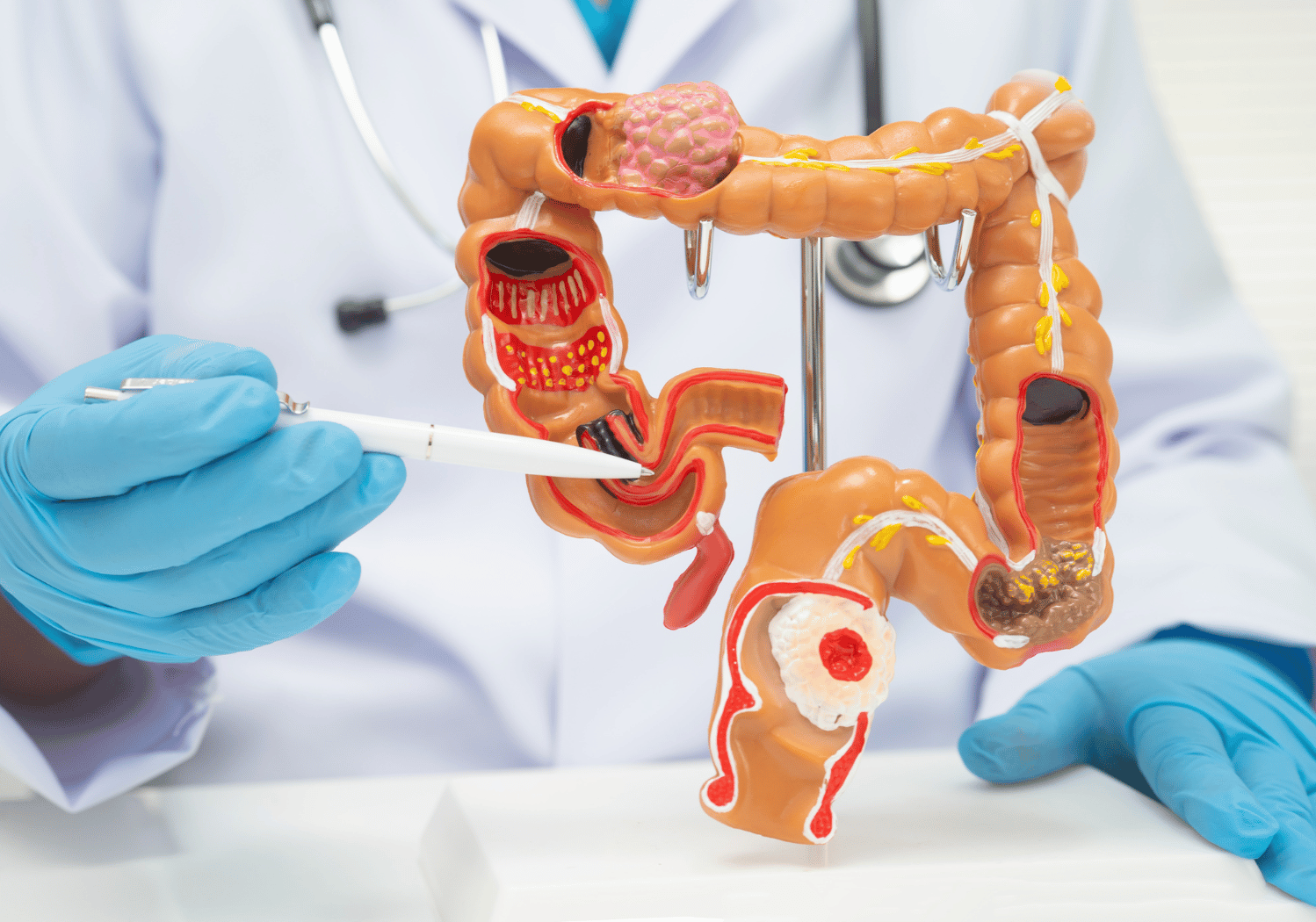 Understanding Rectal Bleeding: Causes, Symptoms, and When to Seek Care