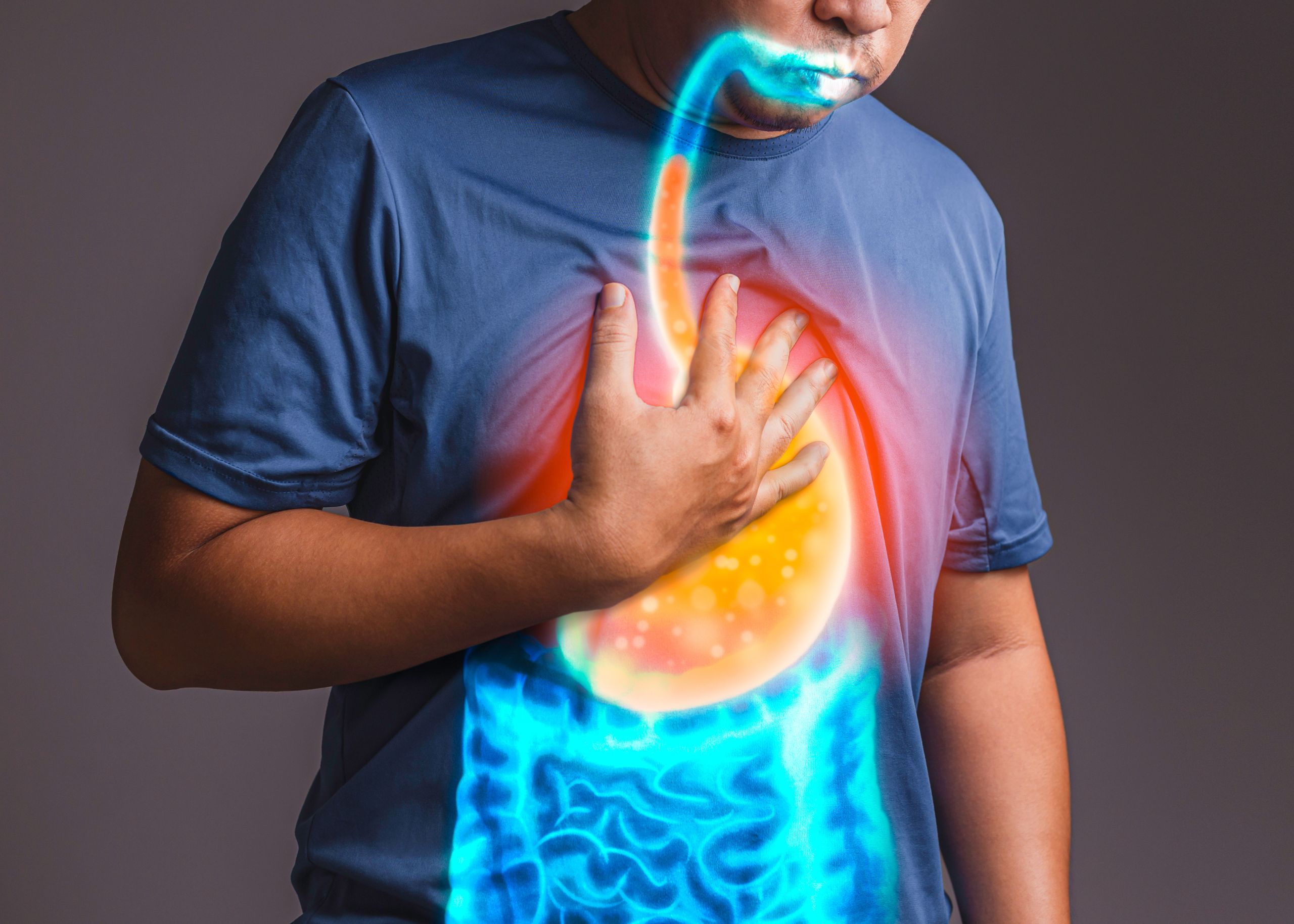 Gastroesophageal Reflux Disease (GERD) – Symptoms, Causes & Treatment