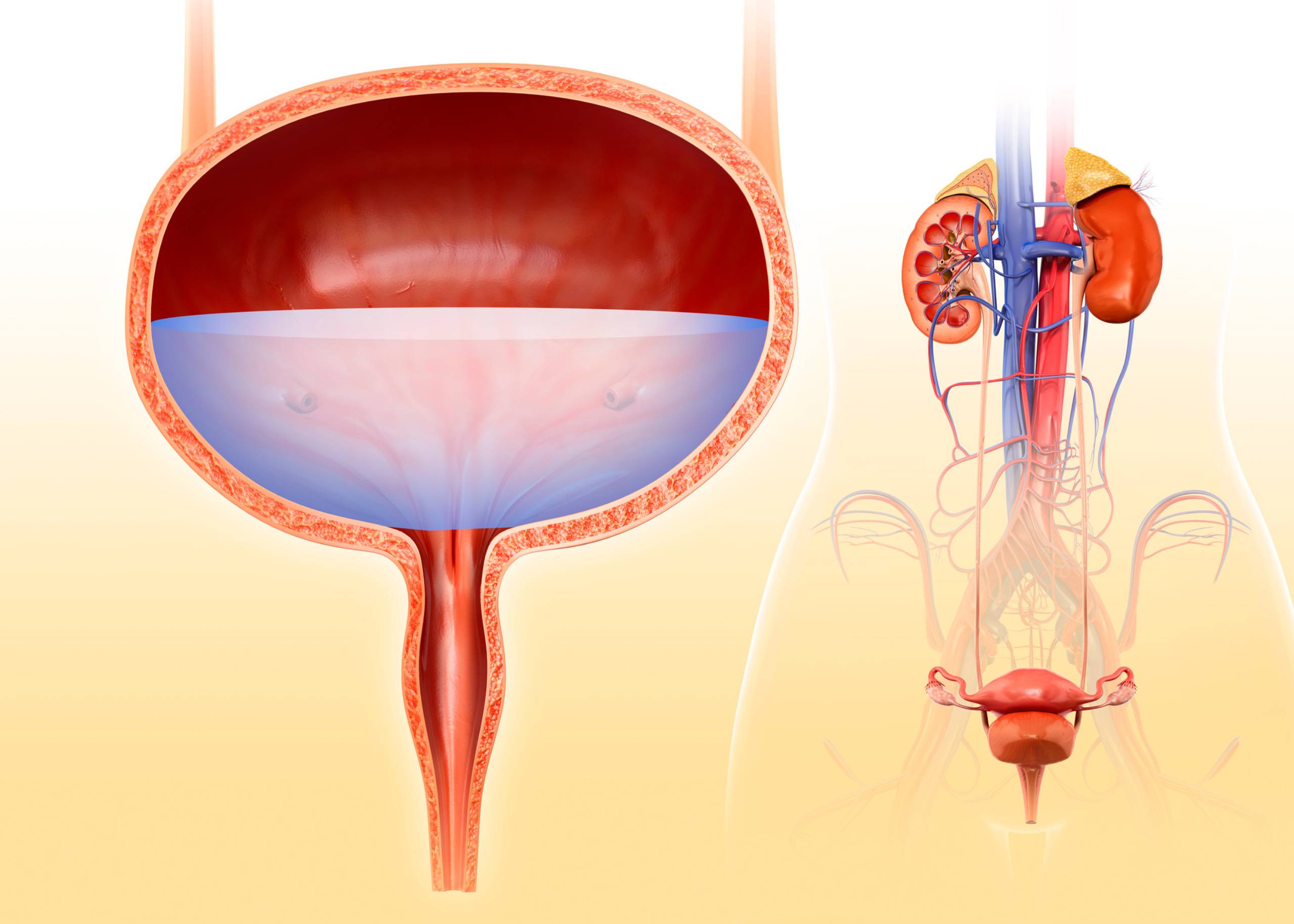 Bladder Cancer – Symptoms, Causes & Treatment