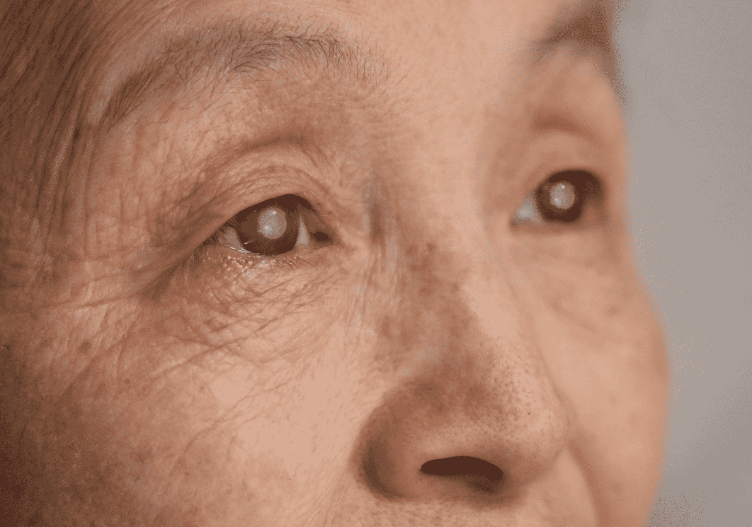 How Cataracts Cause Veil Blocking Vision and What You Can Do About It