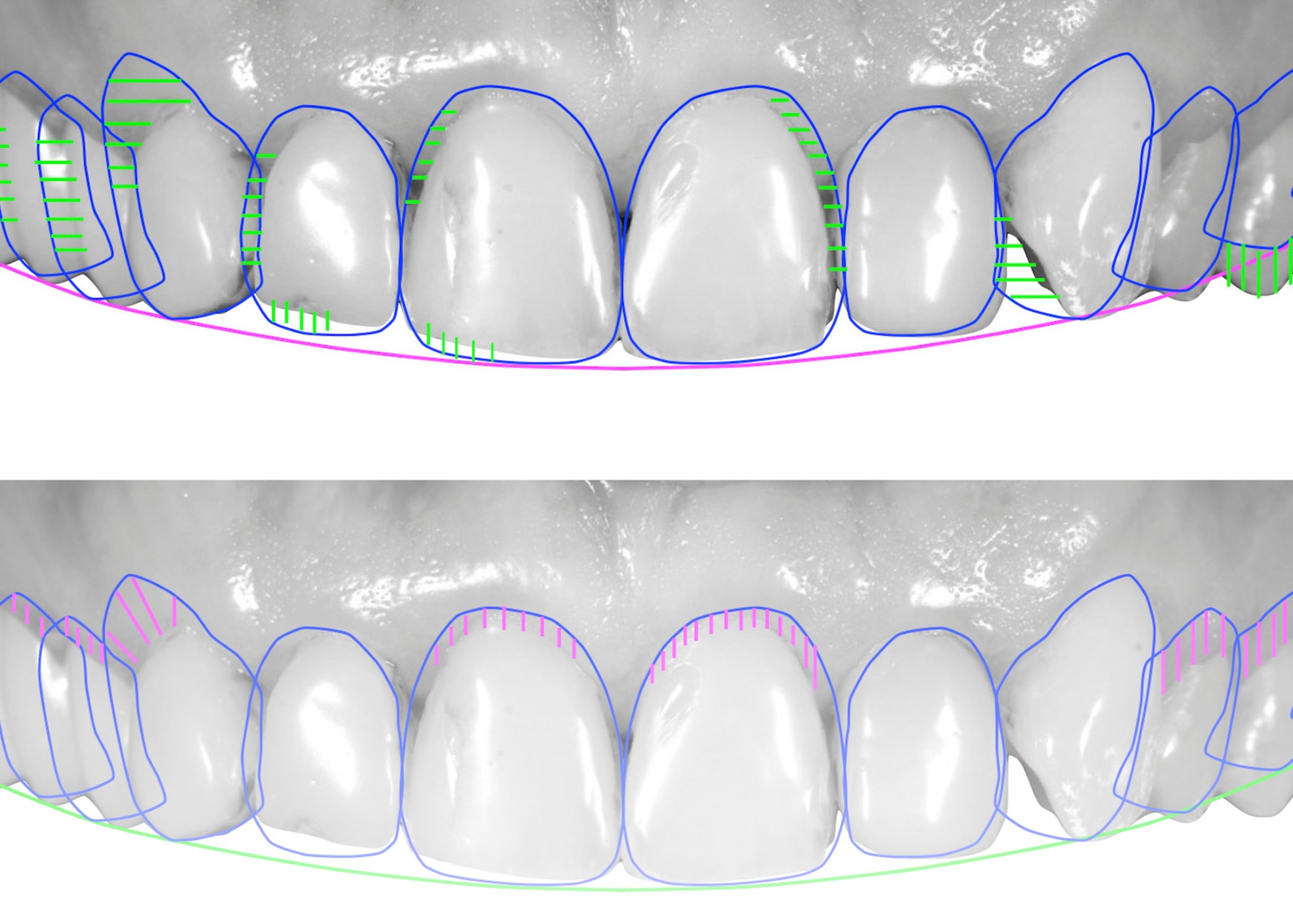 إطلاق العنان للجمال: قوة تصميم الابتسامة الذكية في طب الأسنان