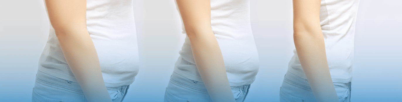 Bariatric and Weight Management Packages