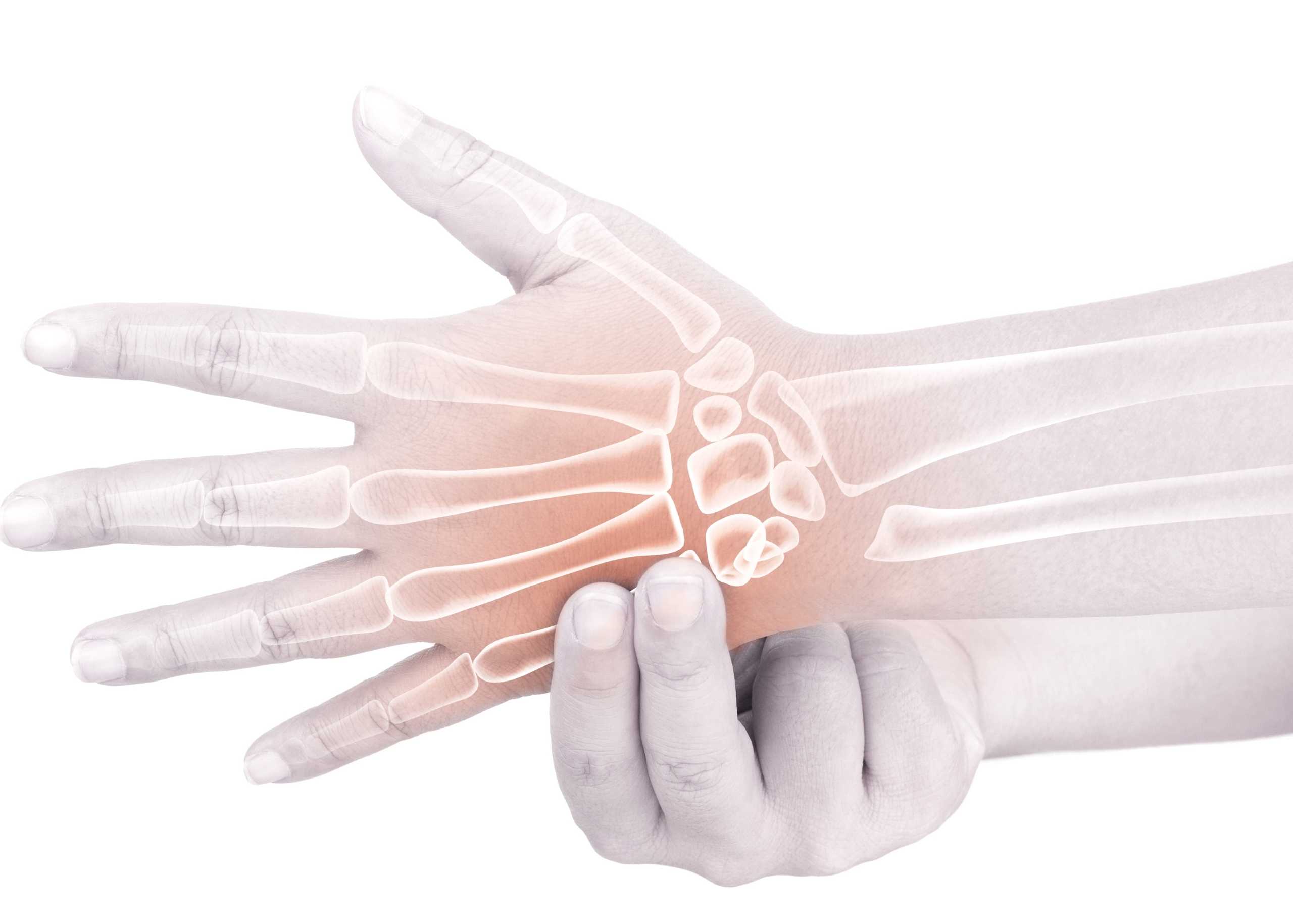 Hand Fracture – Signs, Symptoms, and Treatment