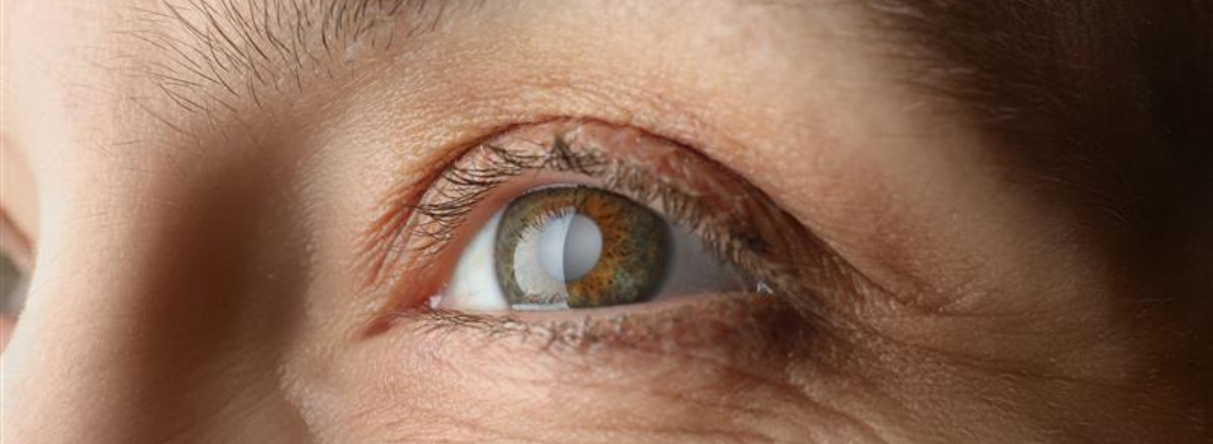 How Hypertension and Diabetes Impact Your Eye Health: A Guide to Glaucoma 