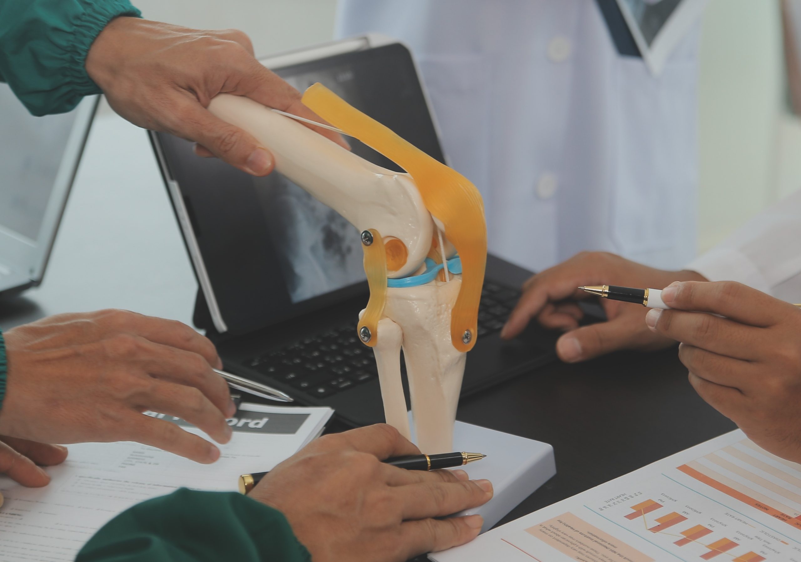 ACL Tear Recovery Timeline: Surgery vs. Non-Surgical Treatment