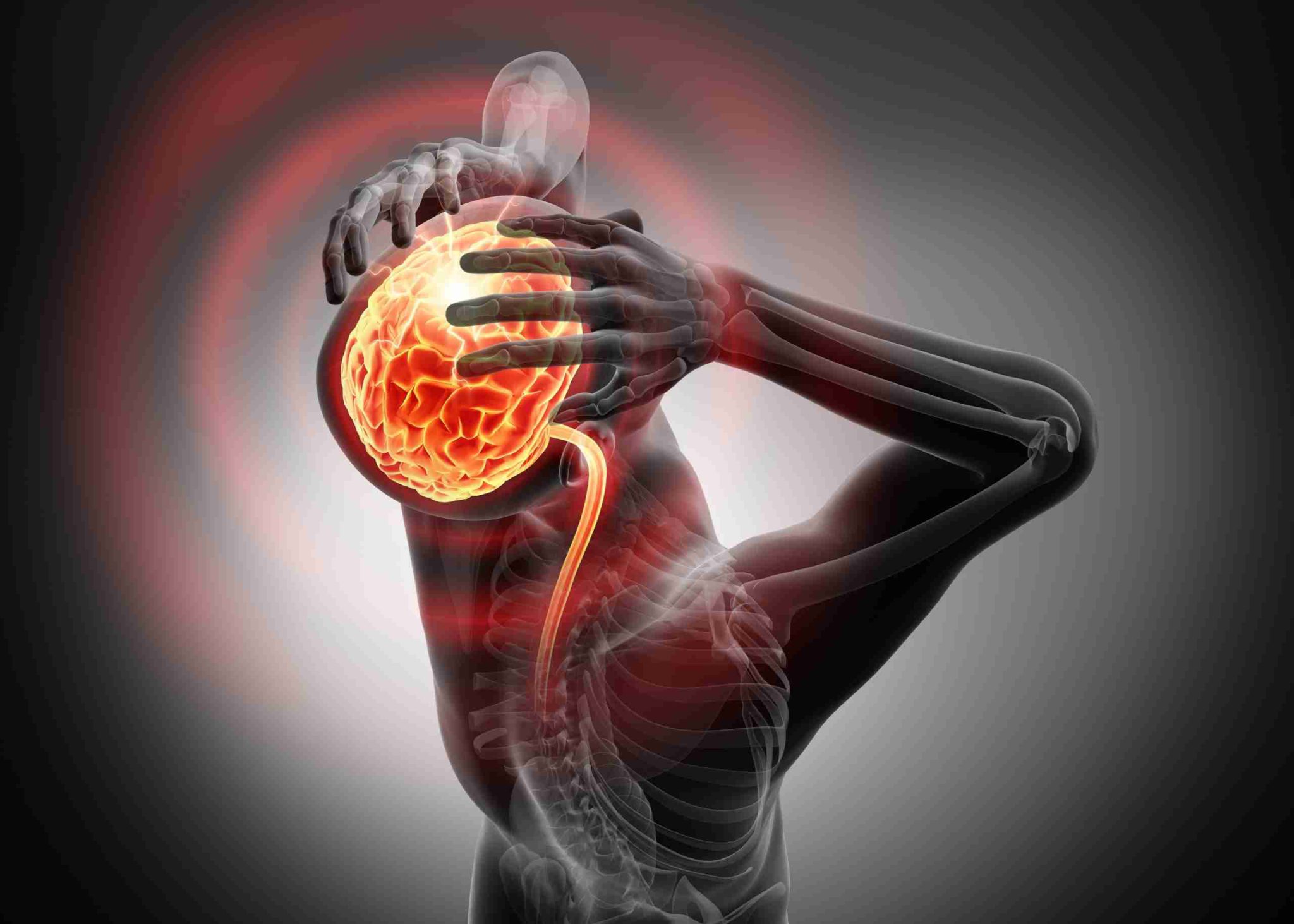 Idiopathic Intracranial Hypertension Symptoms Causes Treatment