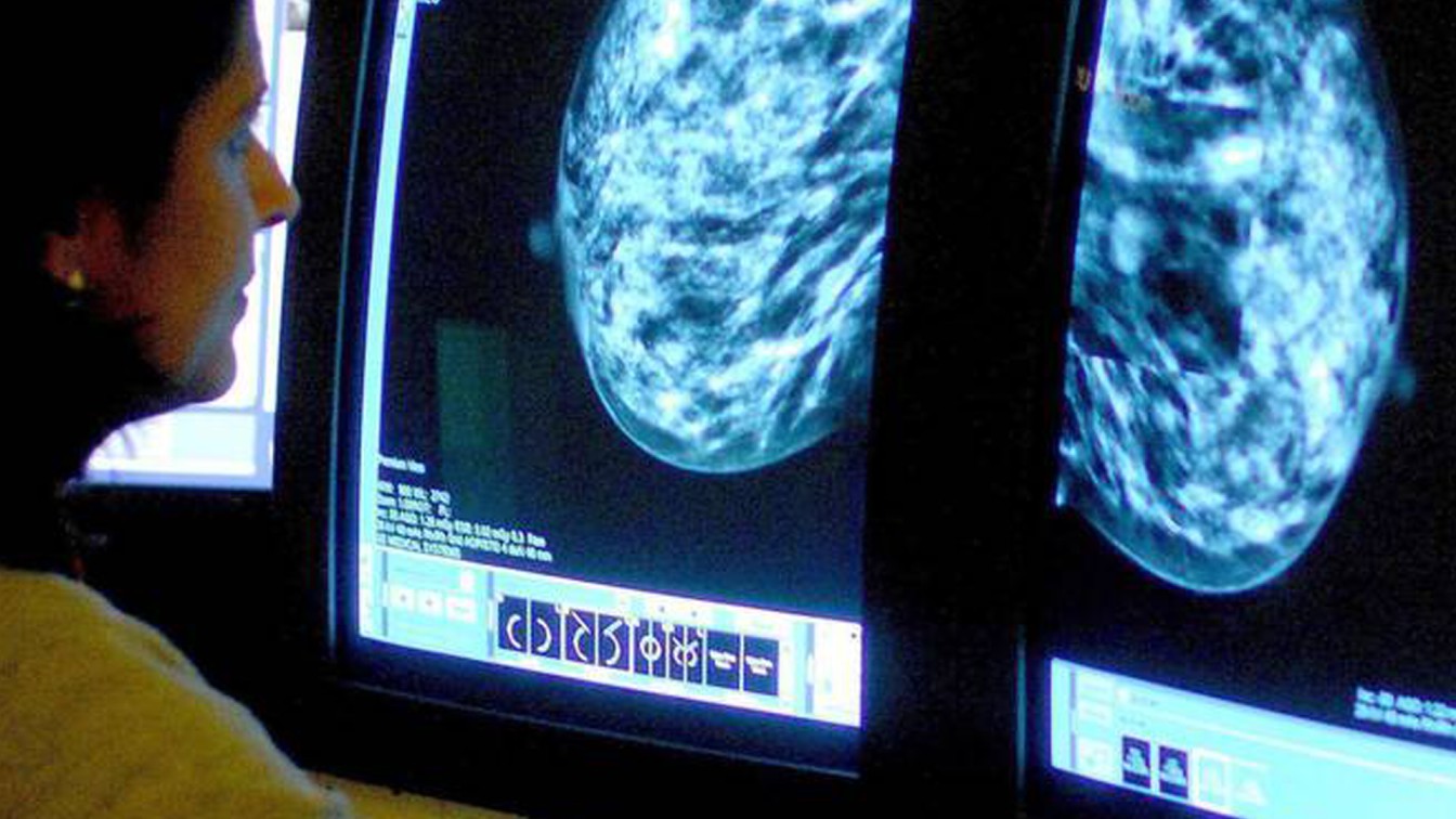 High breast cancer survival rate in UAE due to better screening, national review finds