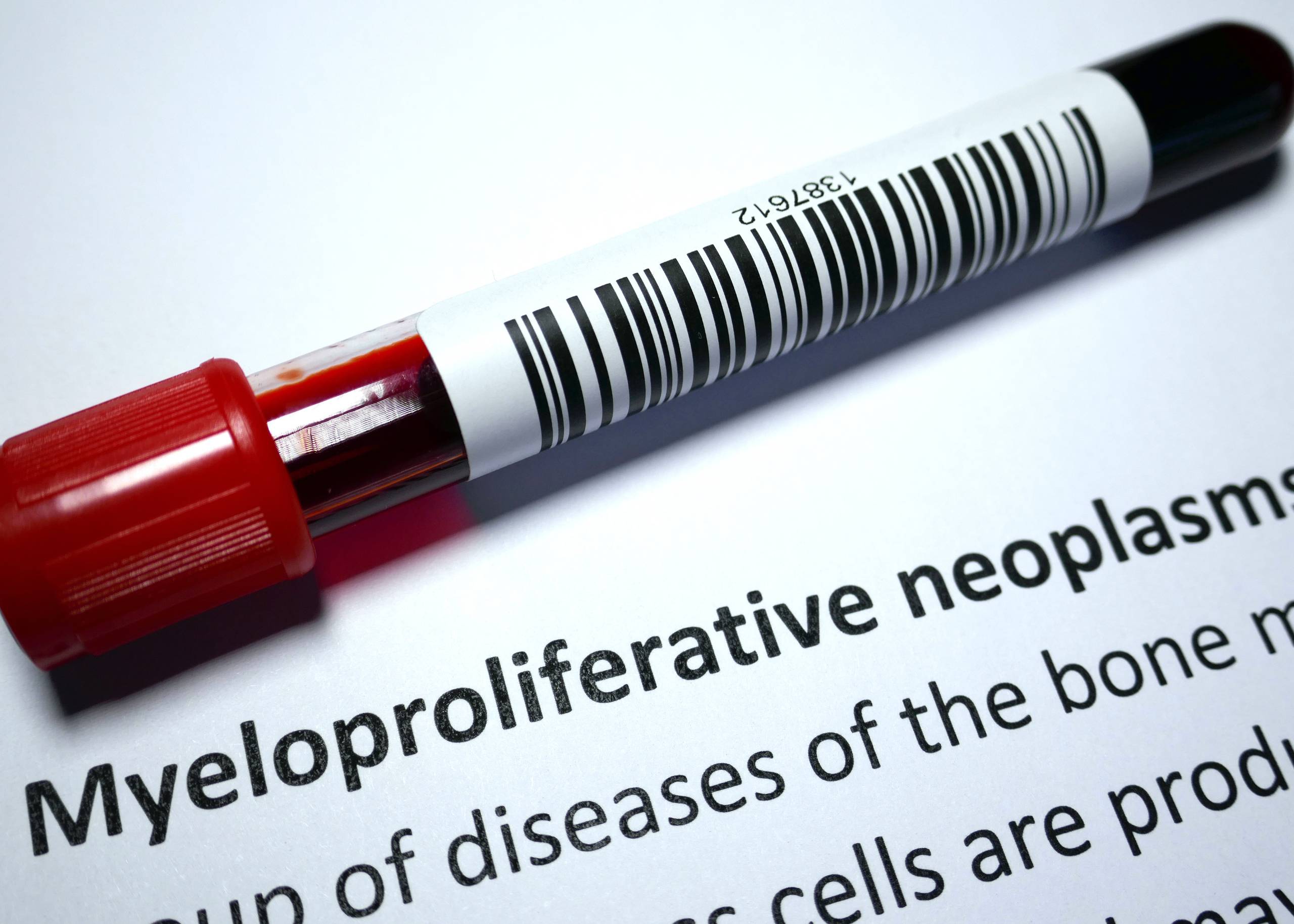 Myeloproliferative Neoplasms (MPN) – Symptoms, Causes & Treatment