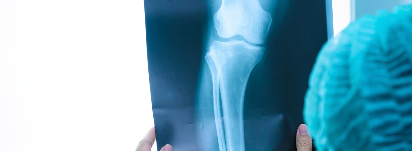 Orthopedics and Sports Medicine Burjeel Hospital