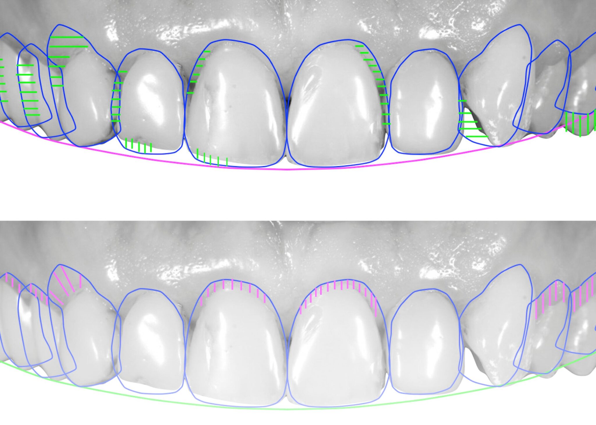 Smart Smile Design in Dentistry | Burjeel Hospital Abu Dhabi