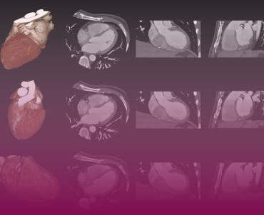 Electrophysiology