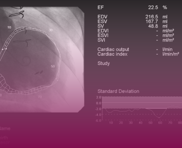 Heart Failure and Transplant Cardiology