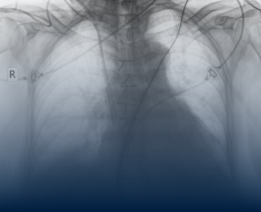 Chest Wall and Airway Surgery