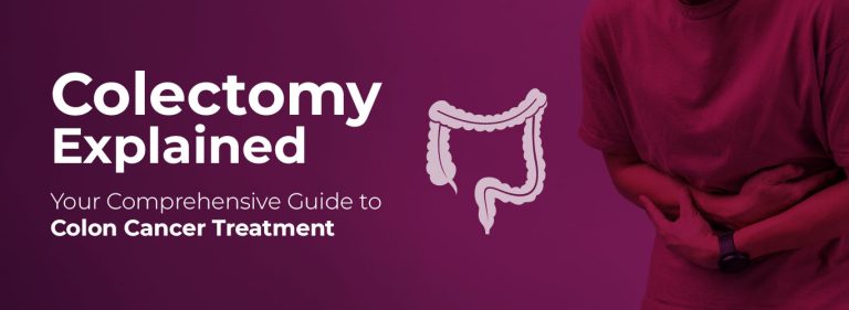 Colectomy and Colon Cancer: Understanding the Surgery and Recovery Process