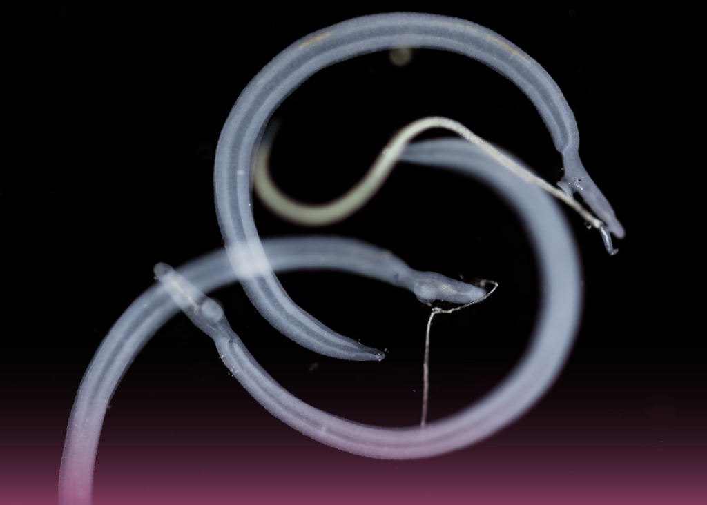 Insect Bladder Diagnosing Urinary Schistosomiasis: Clinical Case Report