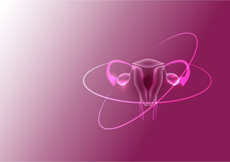 Complete Guide to PCOS Management & Treatment Options